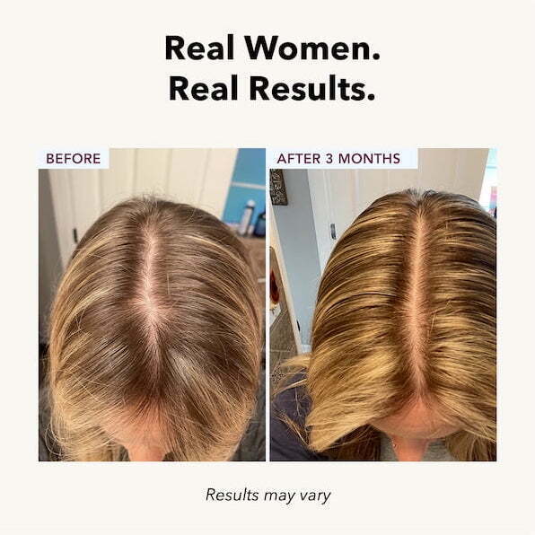 FullyVital Hair Serum - Image 3
