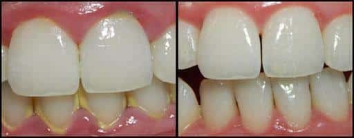 cleaning-and-polishing Cleaning and polishing