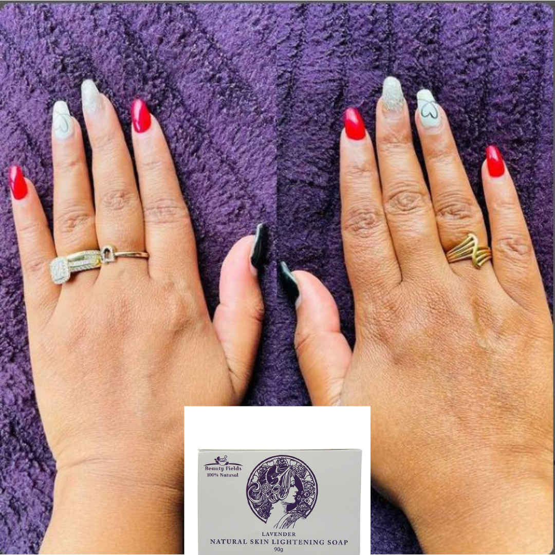 Brightening Soap - NZ Made All Natural Before & After Pigmentation