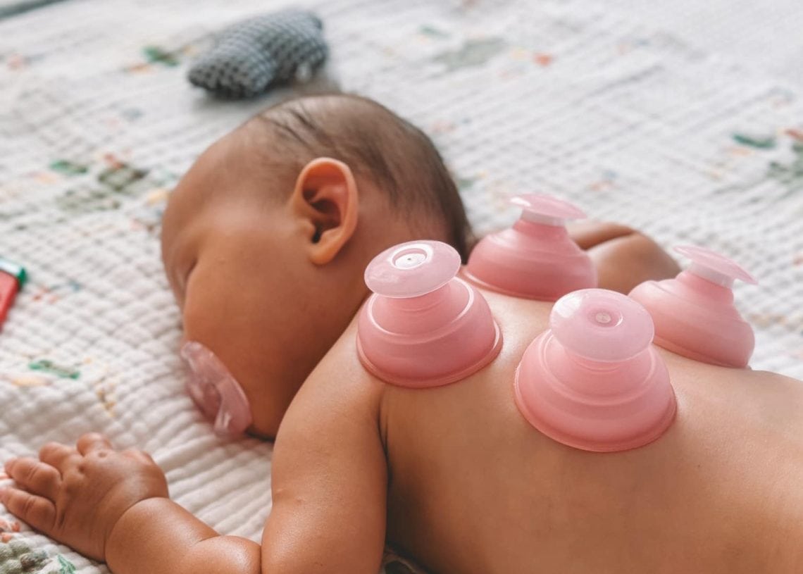 A baby is lying on a quilted blanket with eyes closed, using a pacifier. The baby has small, pink silicone suction cups on its back. There are soft toys and items in the background.