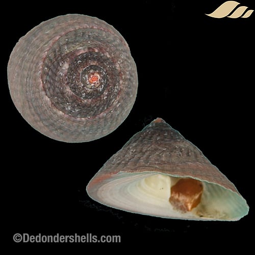 Infundibulum concavum 1