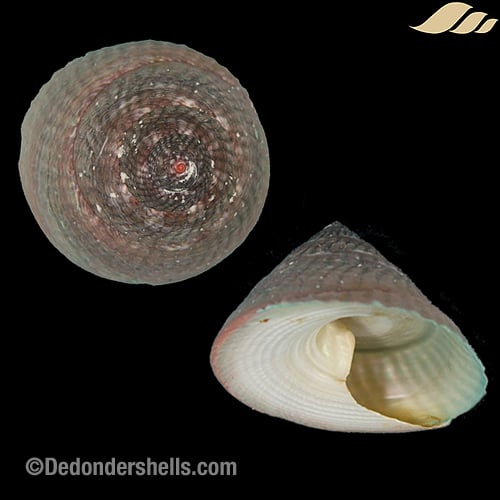 Infundibulum concavum 7