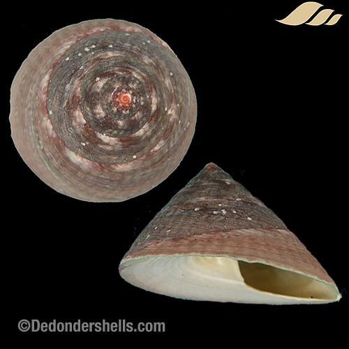 Infundibulum concavum 2