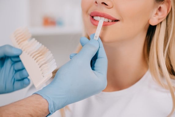 cropped view of male dentist matching teeth color of woman with palette in clinic, teeth whitening blanqueamiento dental