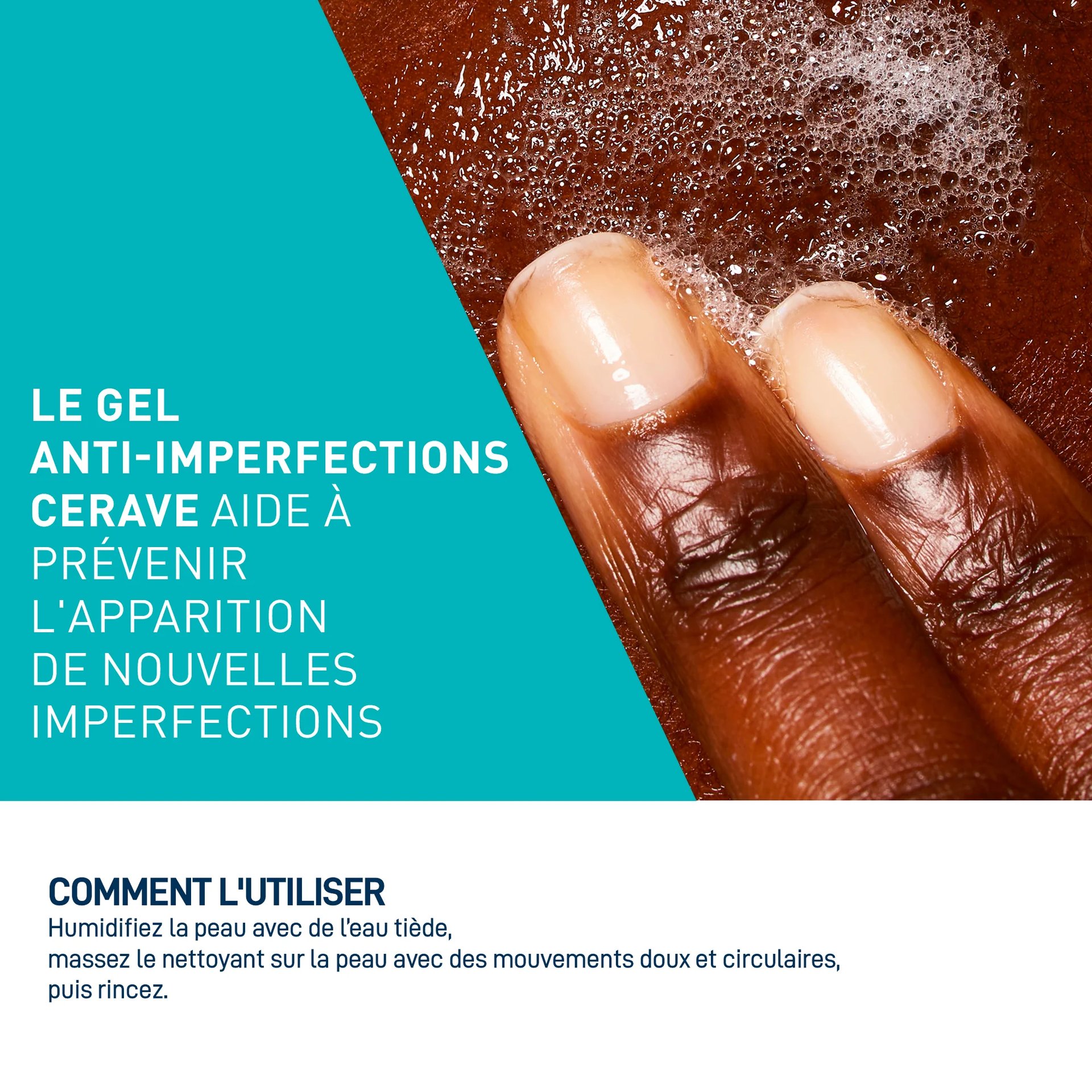 CeraVe Gel Moussant Anti-Imperfections | Peau Grasse à Tendance Acnéique | 236ml
