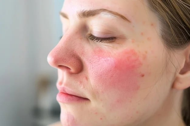 LA ROSACÉE, LES CAUSES ET LES SIGNES!