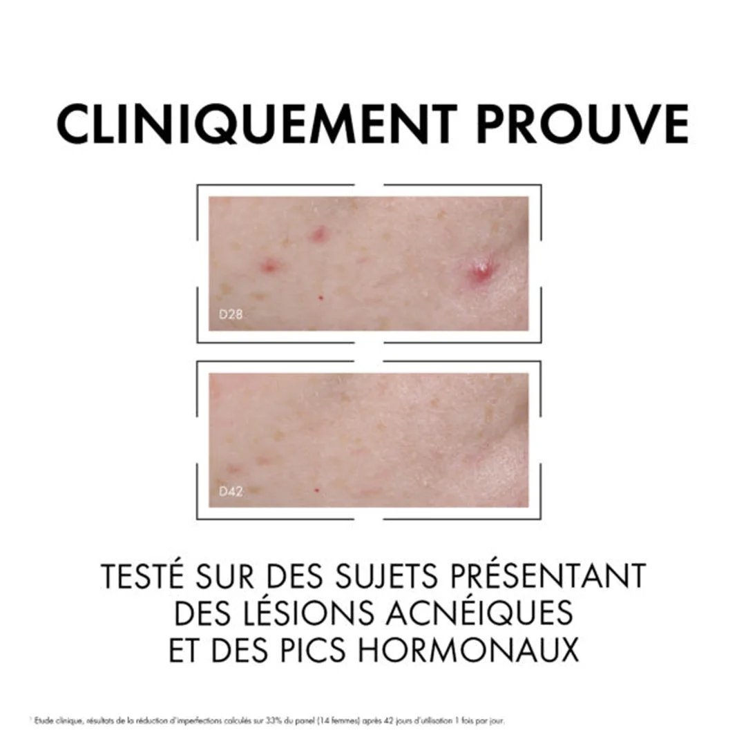 Vichy Normaderm Sérum Anti-Imperfections PROBIO-BHA. Peau Grasse Acnéique | 30ml