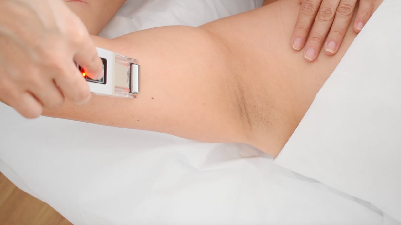 Tratamiento reafirmante de brazos con aparatología estética