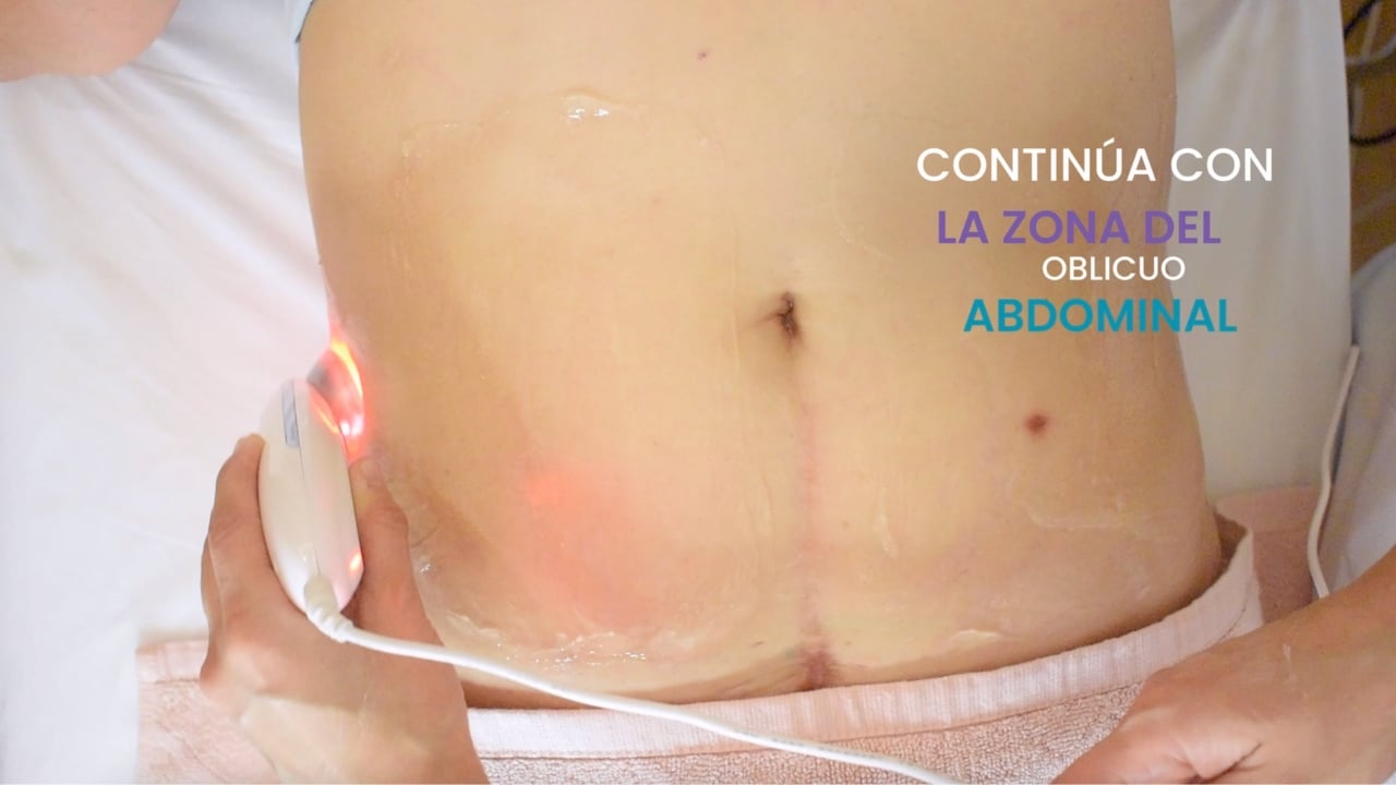 Profesional aplicando tratamiento de electroestimulación en el abdomen de un paciente.