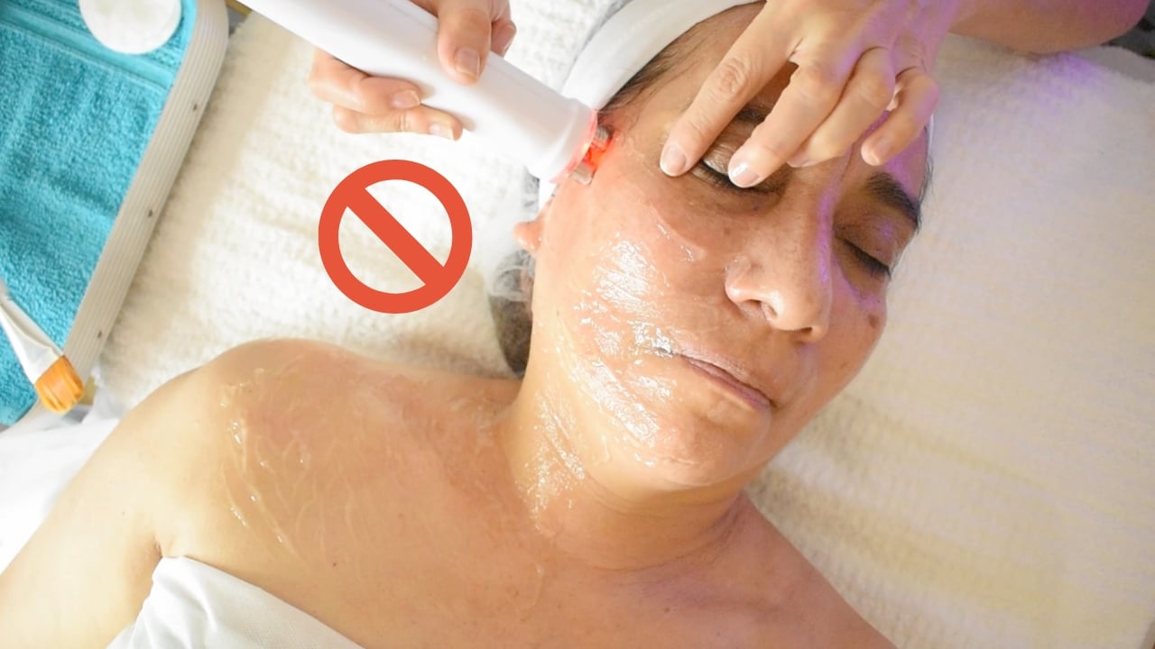 Ejemplo de zona palpebral donde no se debe aplicar radiofrecuencia facial durante el tratamiento.