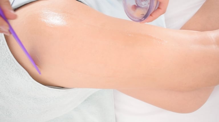 plicación de gel anticelulítico con corriente galvánica en muslo.