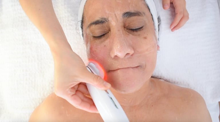 Técnica de electroestimulación facial aplicada en la zona de los labios