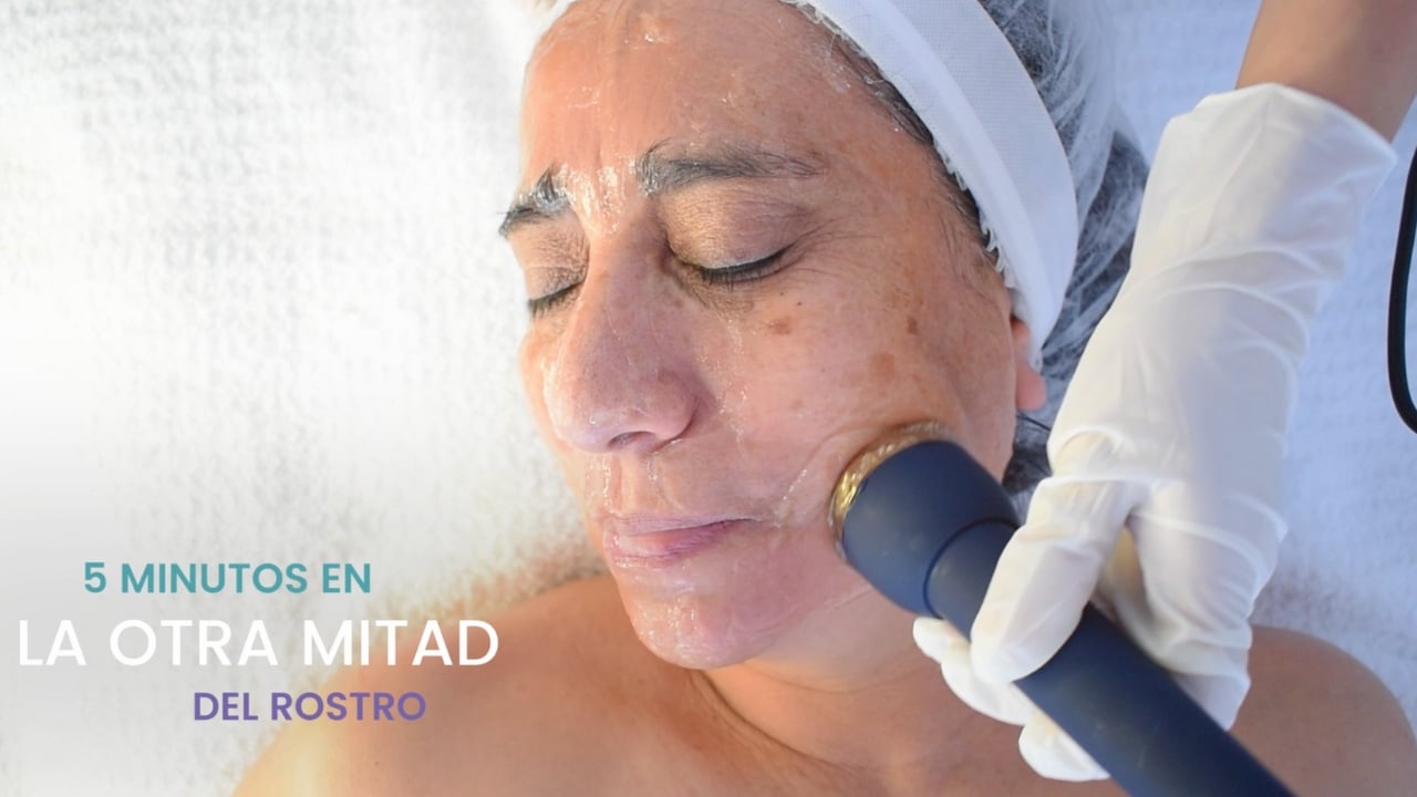 Tratamiento antiarrugas con ultrasonido facial, ideal para reafirmar la piel.