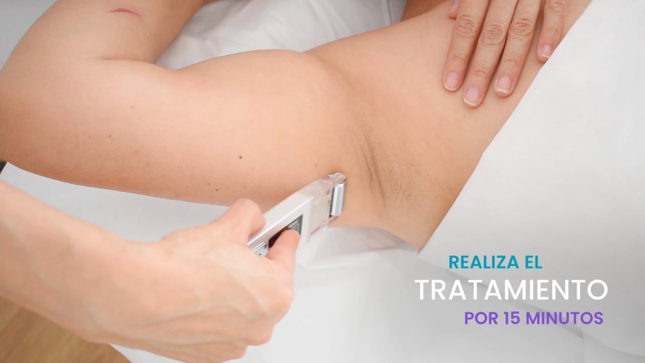 Tratamiento estético reafirmante en zona de axila a codo