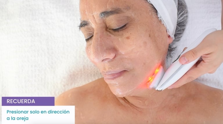 Tratamiento de microdermoabrasión en proceso, mostrando el cuidado preciso para mejorar la textura de la piel.