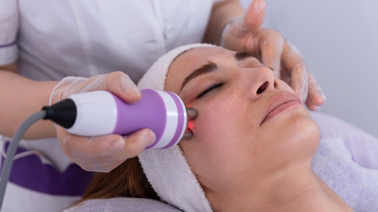 Aplicación de radiofrecuencia facial con maneral multipolar para lifting y reafirmación del rostro.