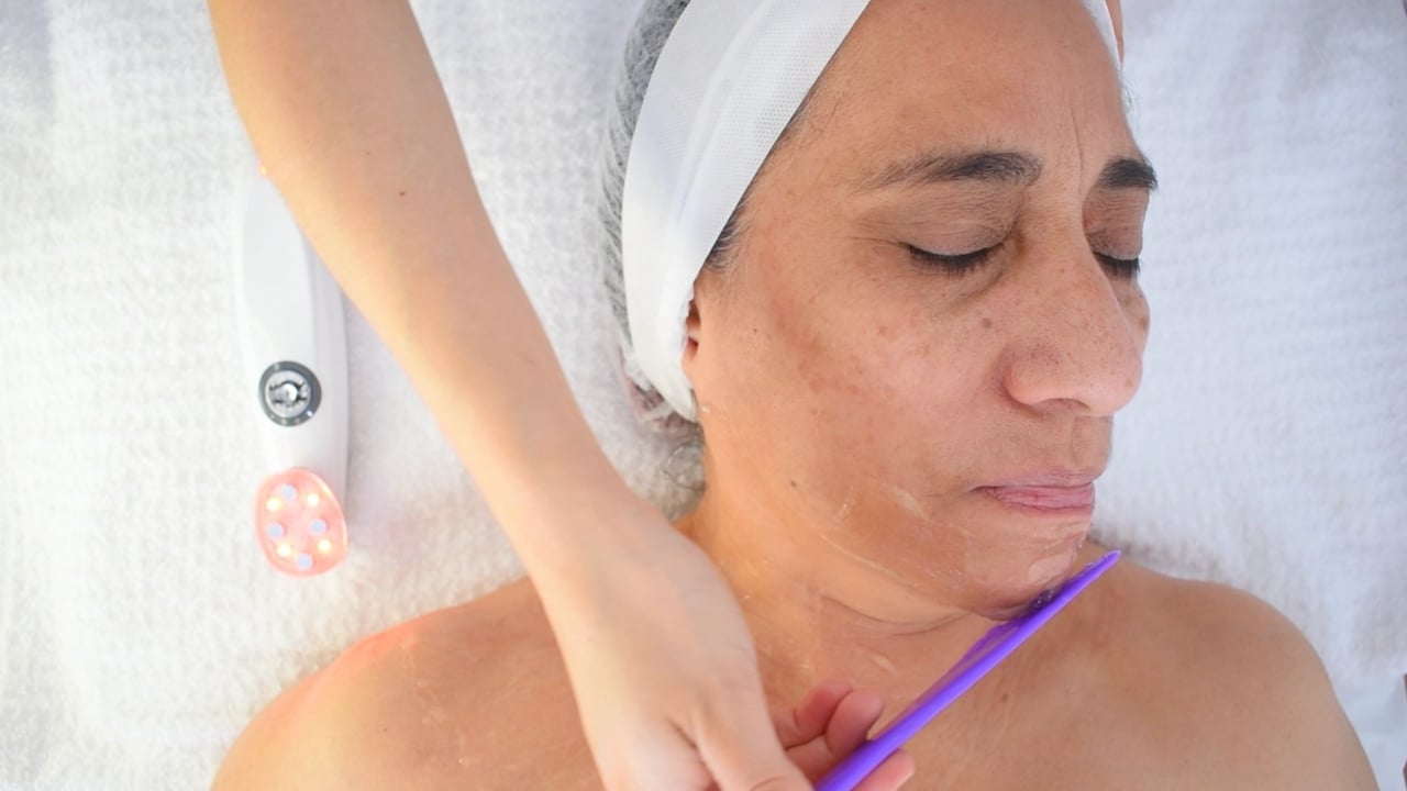 Técnica de microestimulación aplicada en el mentón y maxilar inferior.