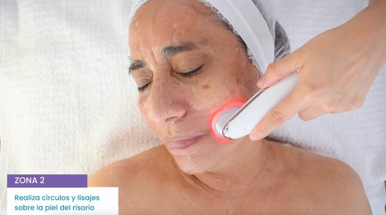 Tratamiento de microdermoabrasión en proceso, mostrando el cuidado preciso para mejorar la textura de la piel.