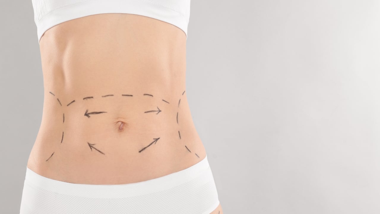 Cosmetóloga aplicando radiofrecuencia corporal en el abdomen como tratamiento estético profesional.