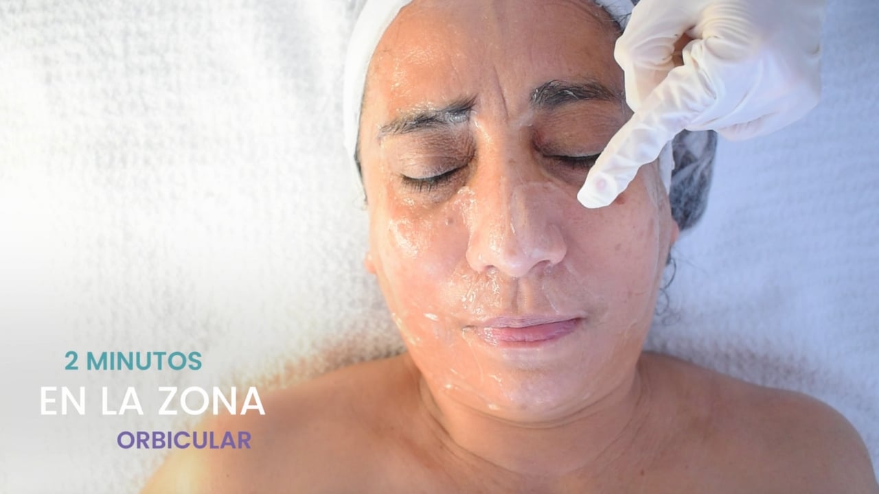 Aplicación de ultrasonido facial en la zona orbicular de los ojos, ayudando a reducir arrugas y mejorar la firmeza de la piel.