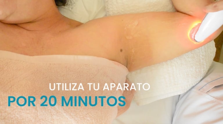 Ilustración destacando el tiempo de la electroestimulación para brazos flácidos.