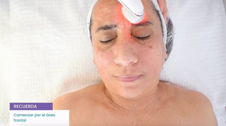 Aplicación de microestimulación facial en la frente y músculos como el piramidal y el superciliar