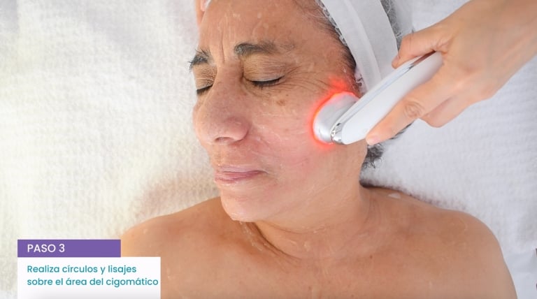 Técnica profesional de microestimulación facial sobre el rostro