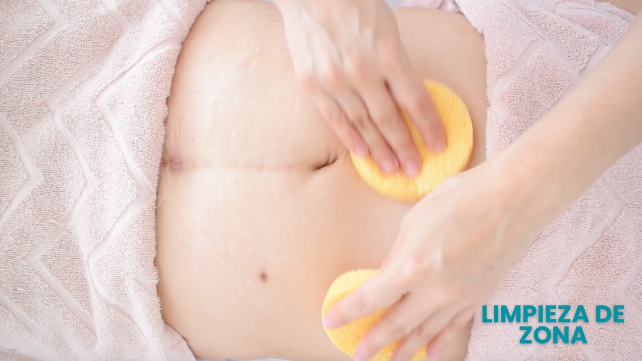 Limpieza del abdomen antes de realizar un tratamiento de radiofrecuencia corporal.