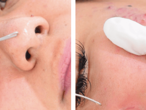 Forma de preparar el rostro de tu cliente Prepara el rostro de tu cliente