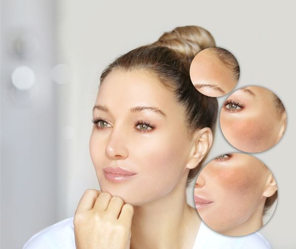 Imagen que resalta las particularidades o características únicas de la piel.