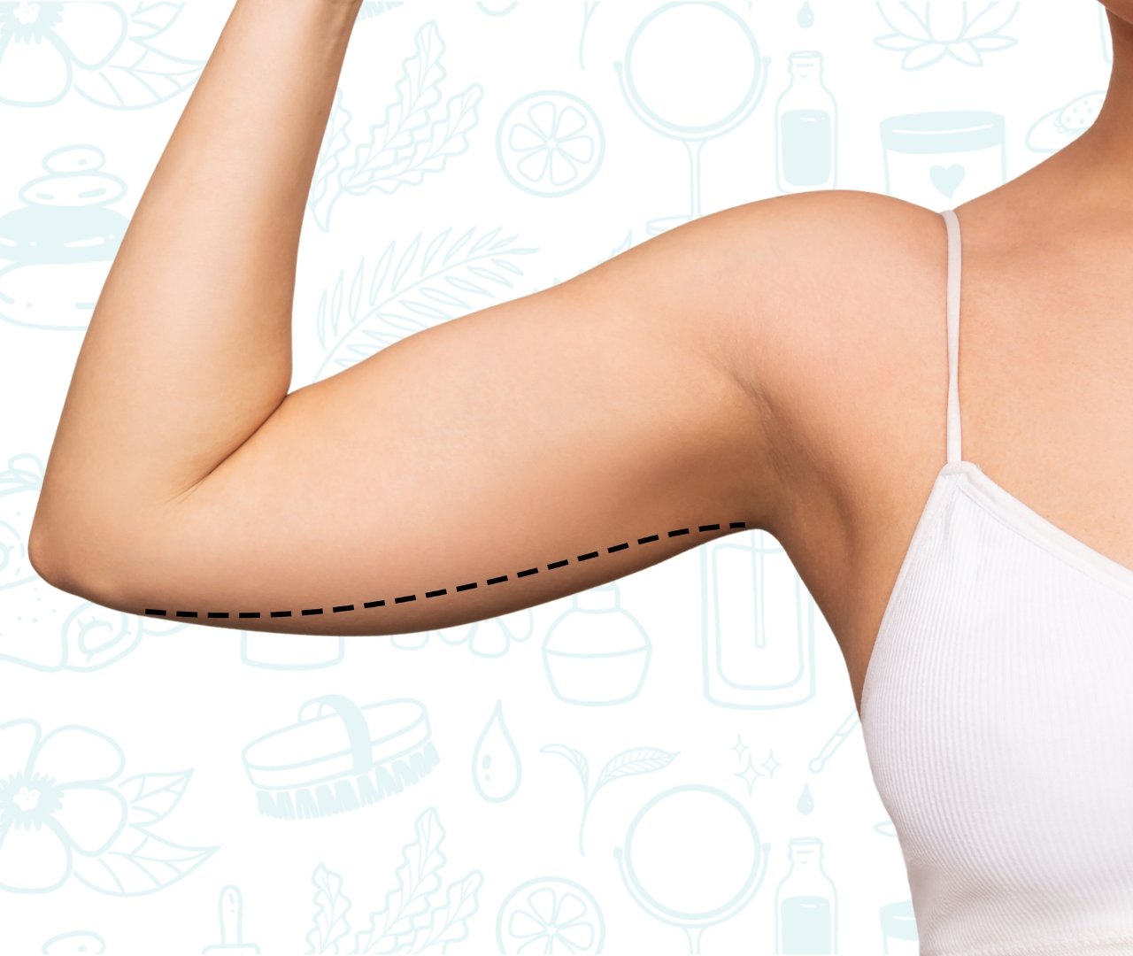 Primer plano de un brazo tonificado después de un tratamiento de electroestimulación efectivo.