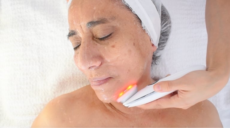 Tratamiento de rejuvenecimiento facial sin cirugía utilizando microestimulación, ideal para revitalizar la piel.