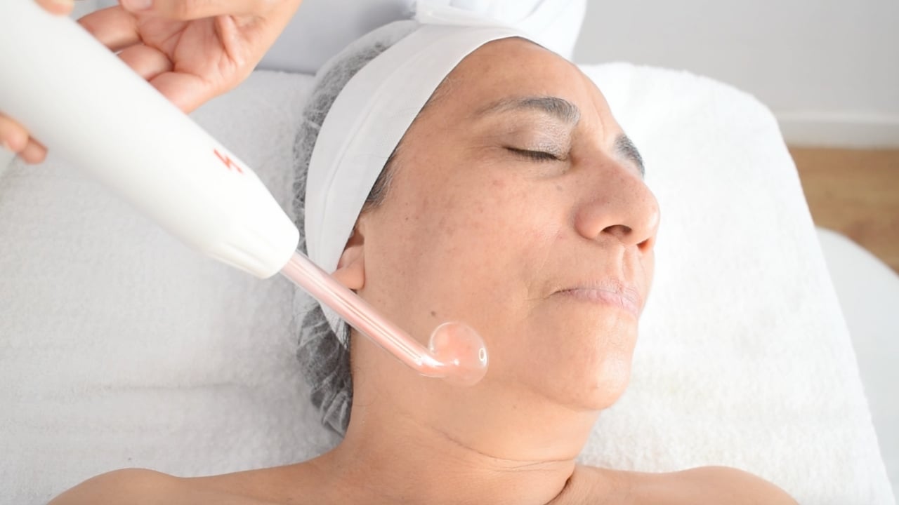 Beneficios de la alta frecuencia facial para piel con acné y tratamiento cosmético.