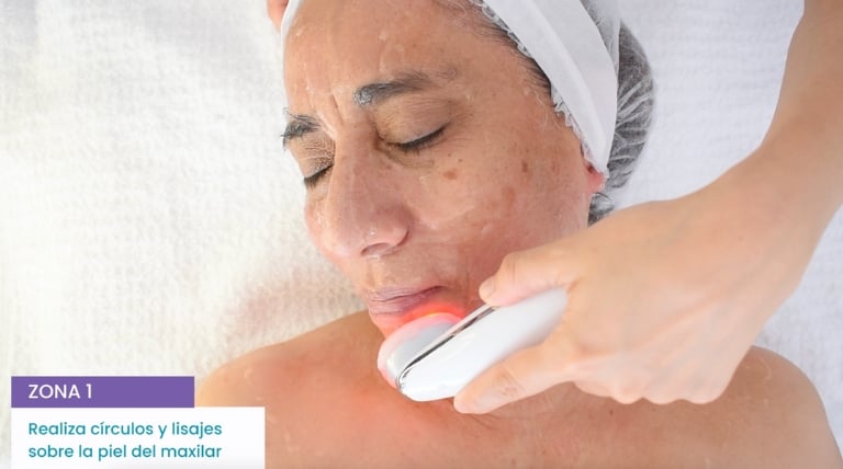 Técnica de plisaje con microestimulación aplicada al maxilar inferior para mejorar la firmeza de la piel.