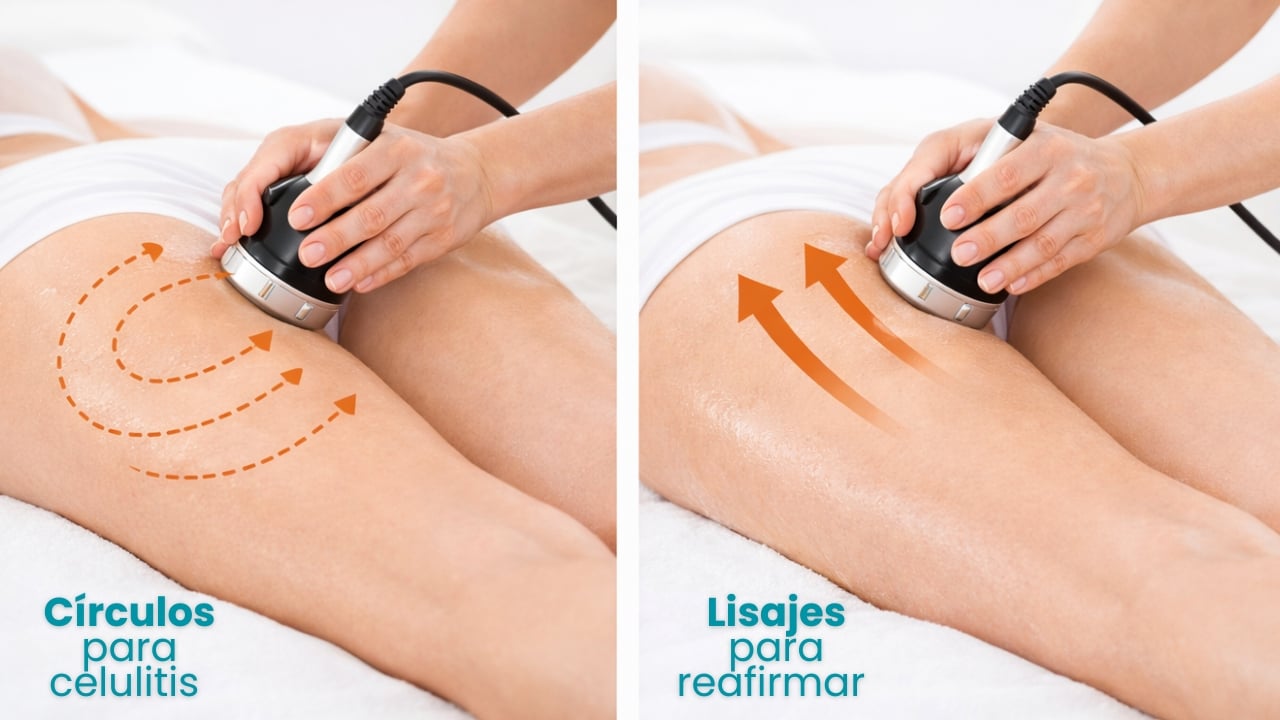 Comparación entre maniobras de círculos para celulitis y lisajes para reafirmar glúteos.