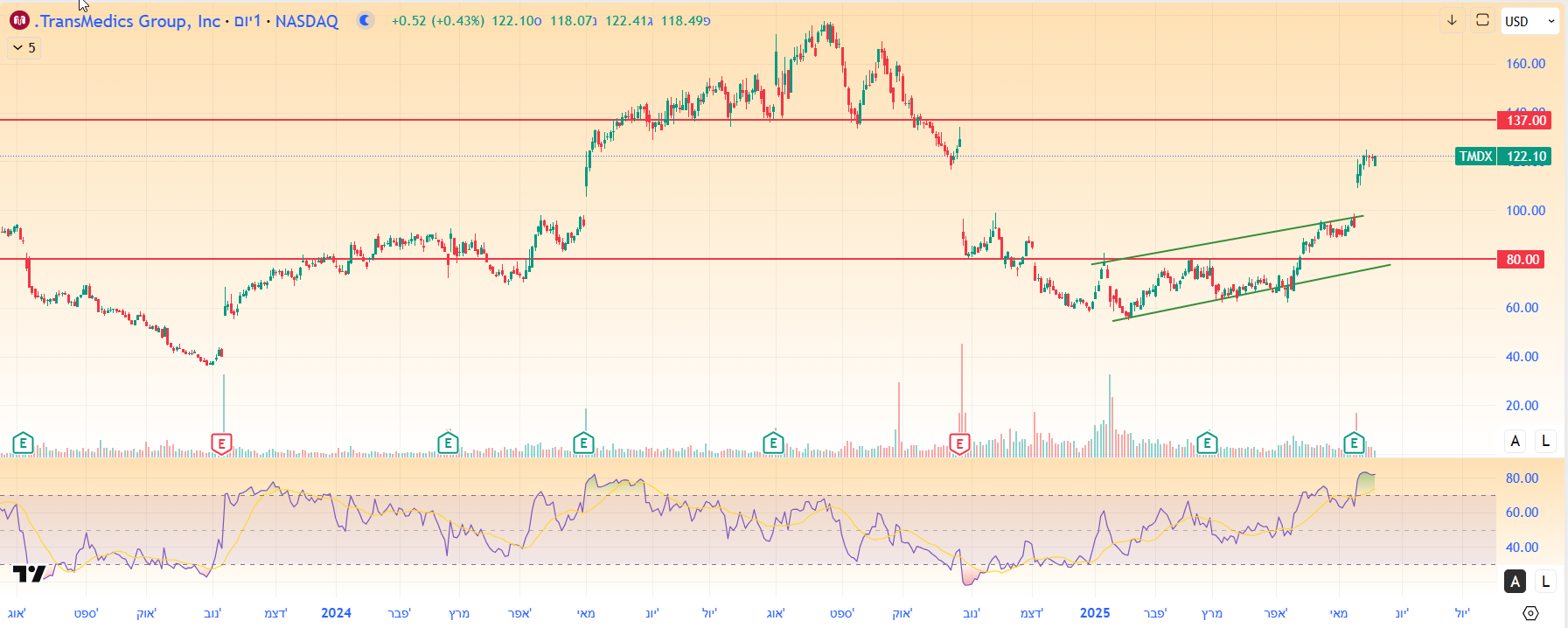מניית טרנסמדיקס