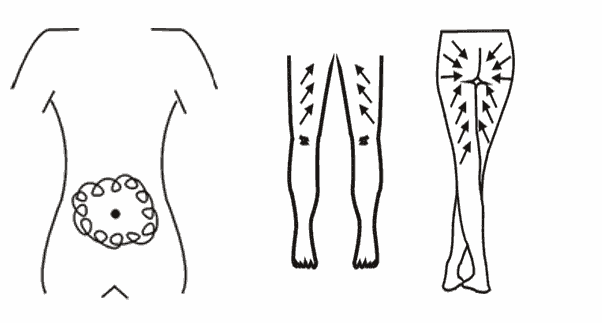 Trei desene simple cu linii arată: ganglionii limfatici din abdomen, săgeți în sus pe picioare și săgeți spre inghinali, ilustrând modelele de drenaj limfatic în legătură cu terapia Vacuum Iasi.