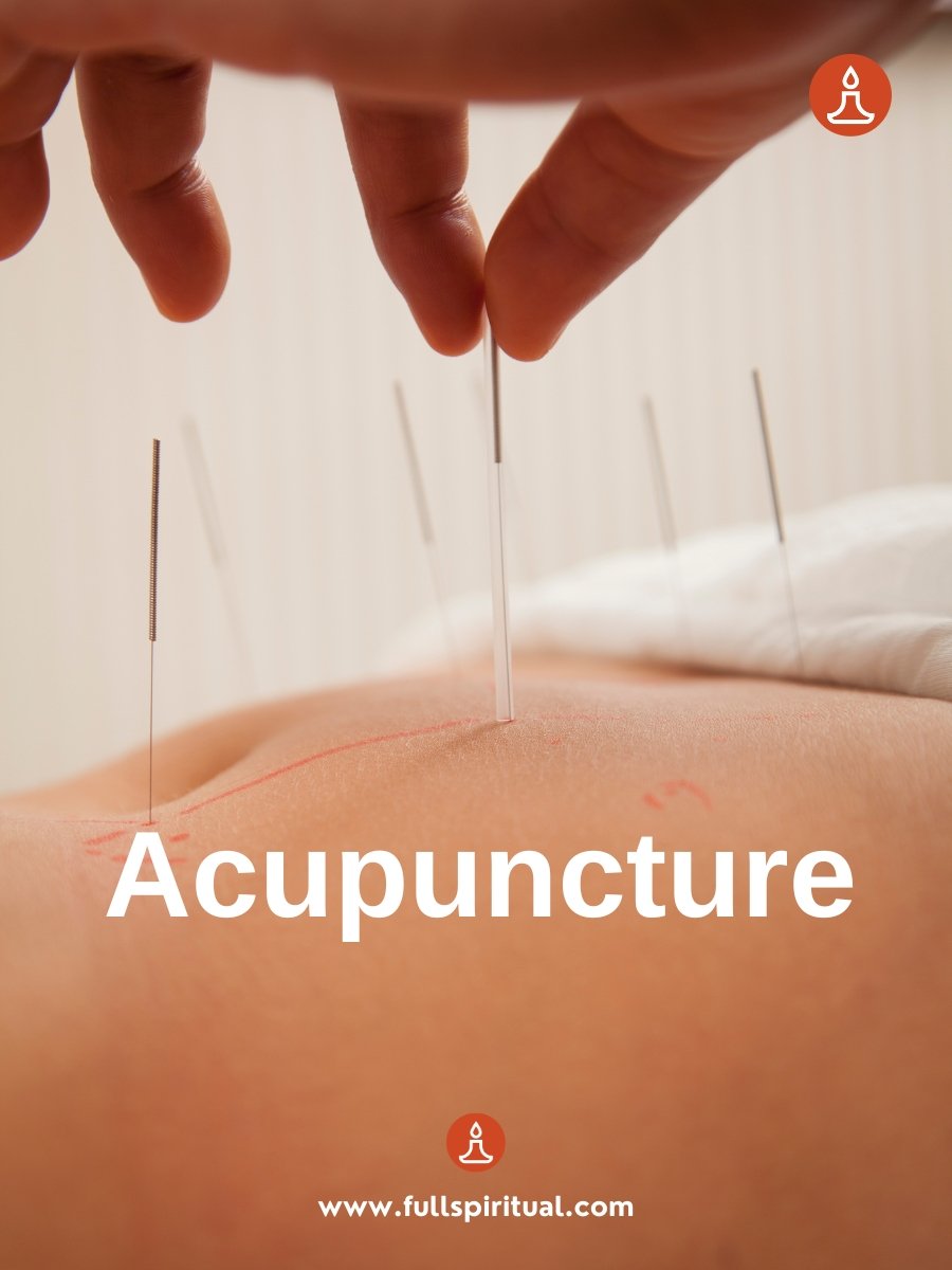 Exploring Alternative Healing Methods. Complementary Therapies and Holistic Modalities 3 Acupuncture