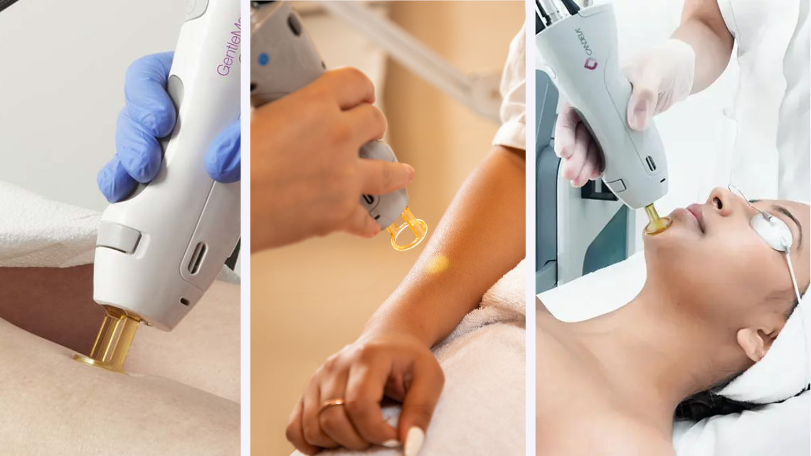 Full Body Laser Hair Removal