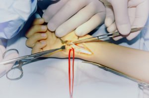 shutterstock 292364051 300x199 1