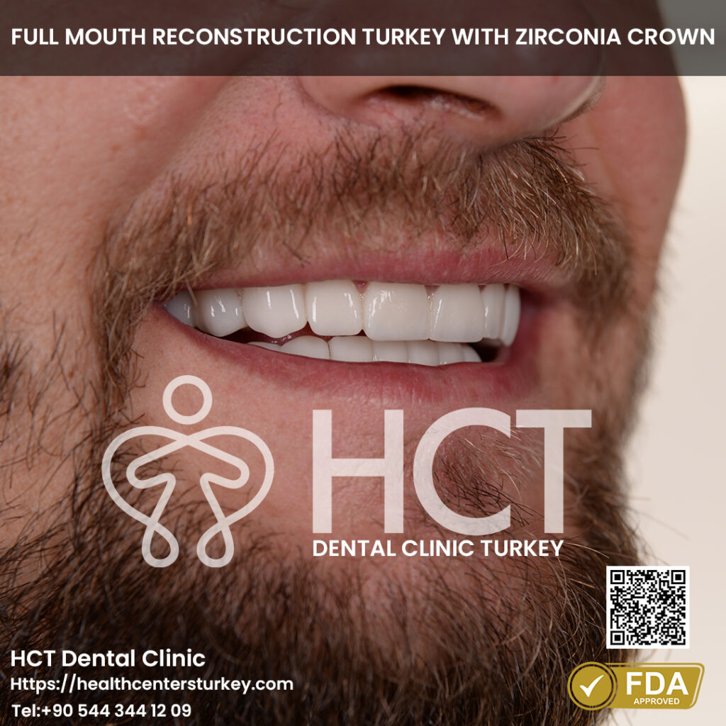 Full Mouth Dental Implants in Turkey 2 Full mouth reconstruction turkey with dental implants and zirconia crowns