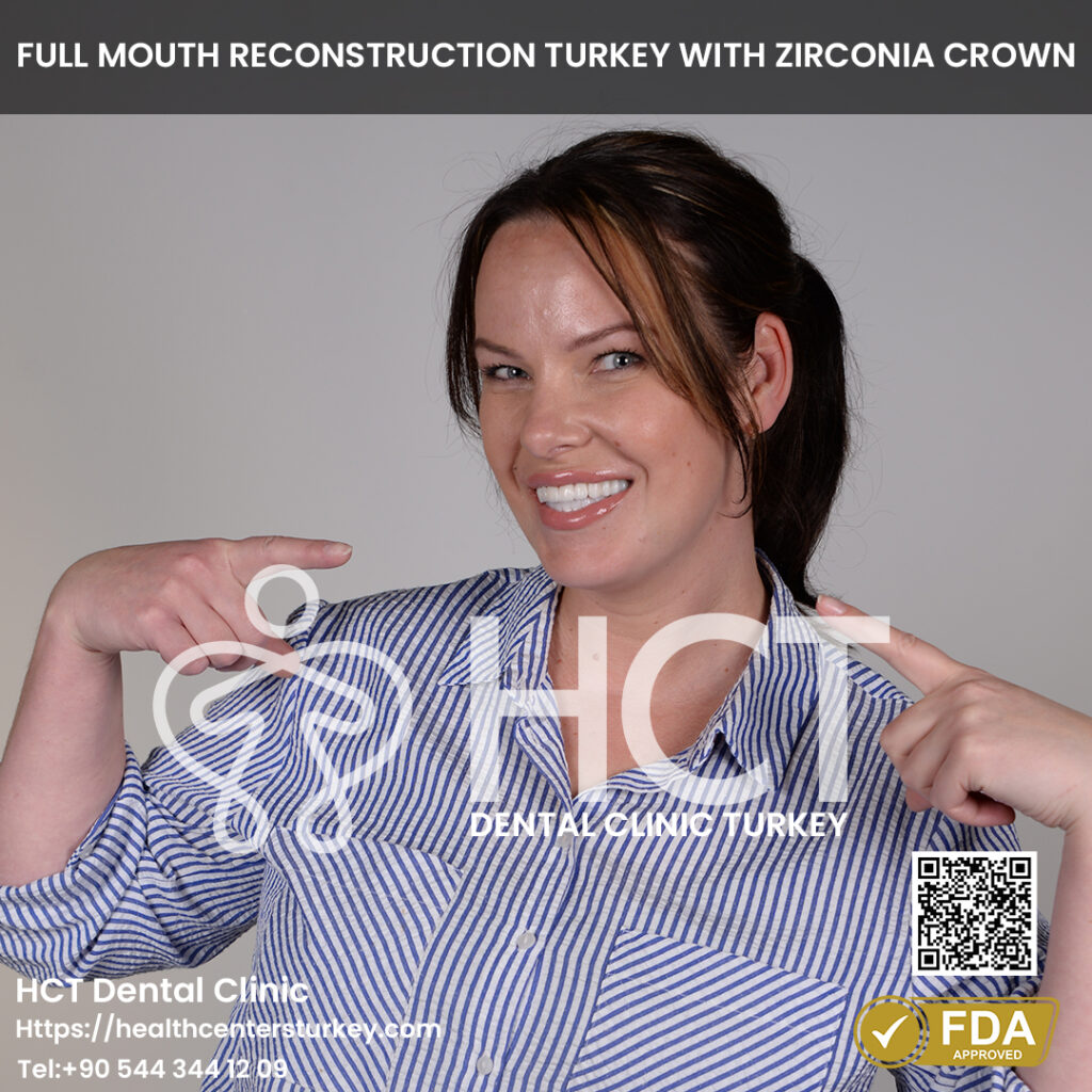 Full Mouth Dental Implants in Turkey 9 hollywood smile reconstruction with dental implants turkey package deals