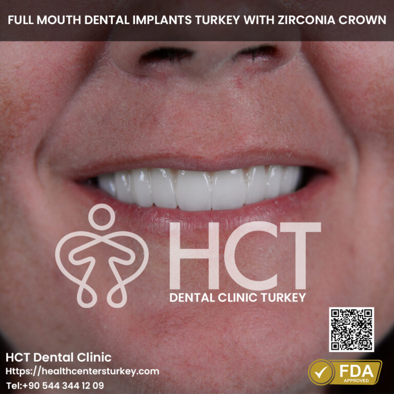 Smile Makeover Turkey 9 Smile Reconstruction with full mouth dental implants turkey package deals final result in antalya
