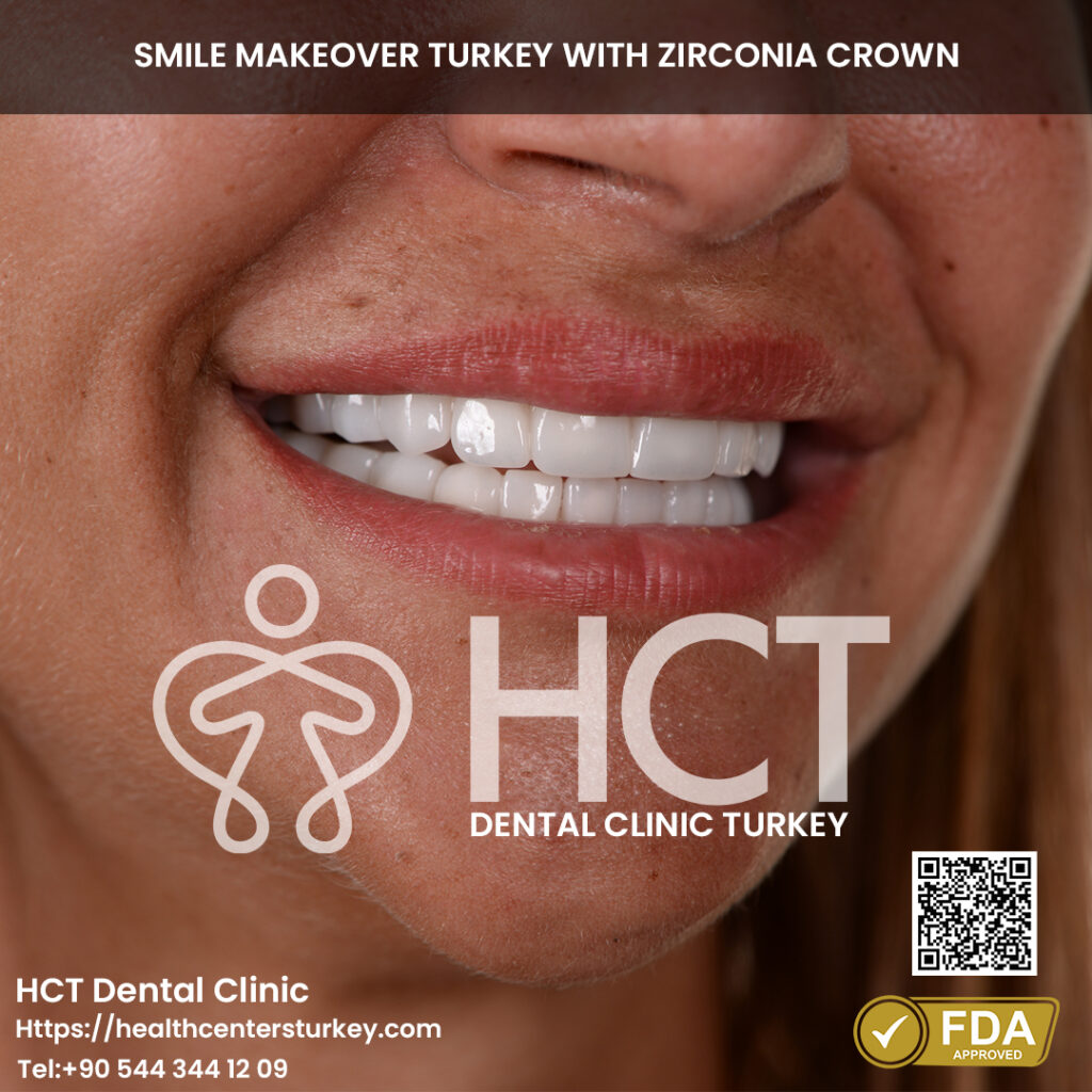 Full Mouth Dental Implants in Turkey 10 smile makeover turkey with zirconia crowns