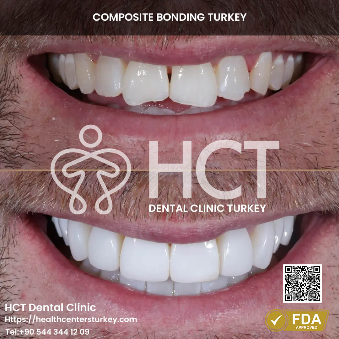 Skilled Dentists Providing Trusted Care in Turkey