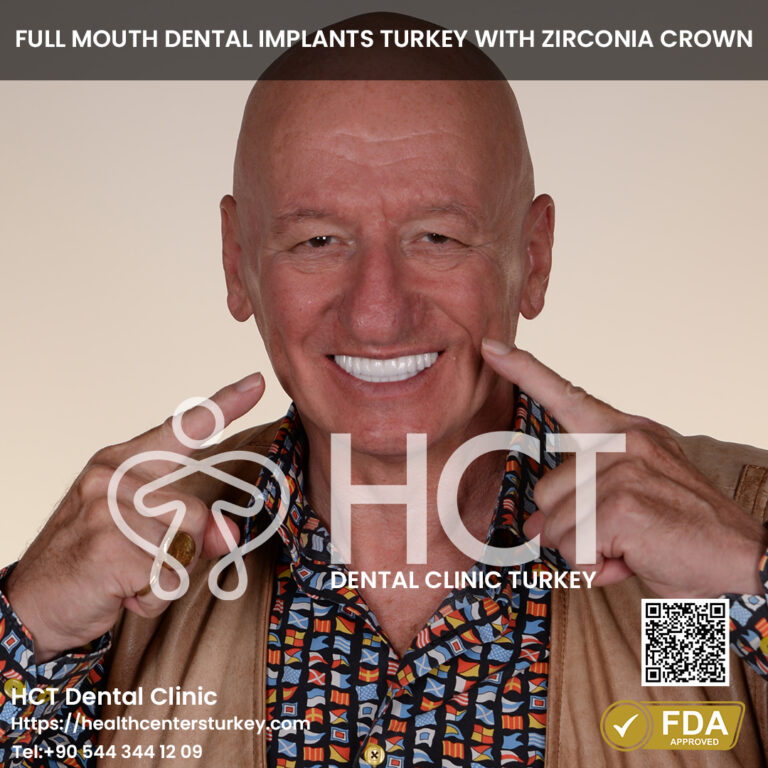 Smile Makeover Turkey 4 all on 4 dental implants turkey package deals in Antalya