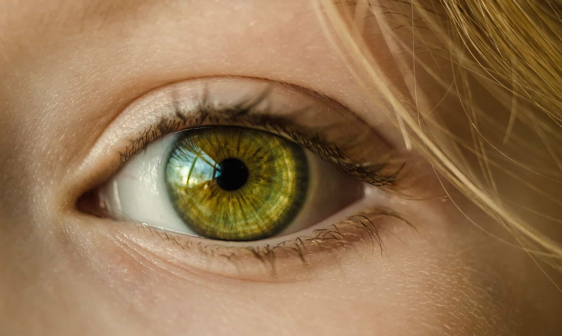 Ursachen für geschwollene Augen, auge, iris, flüge