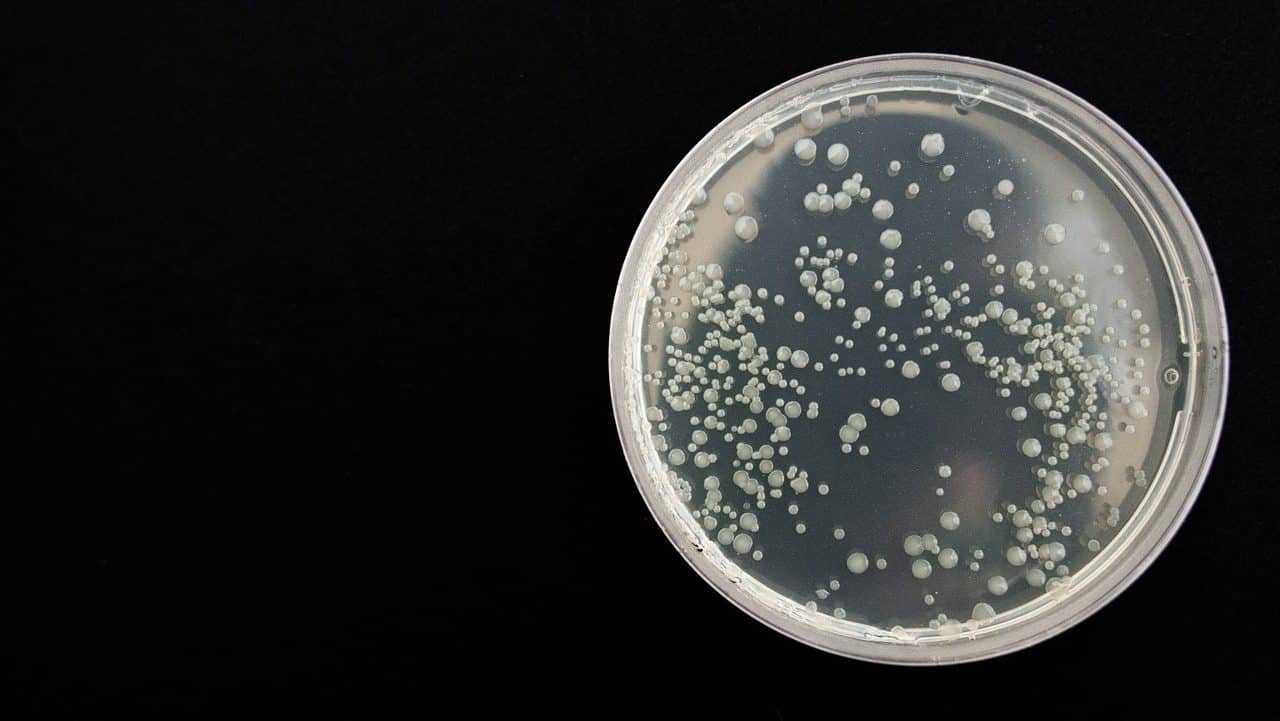 RISIKO UNFRUCHTBARKEIT -CHLAMYDIEN SIND DIE HÄUFIGSTE SEXUELL ÜBERTRAGBARE INFEKTION IN DEUTSCHLAND img-4