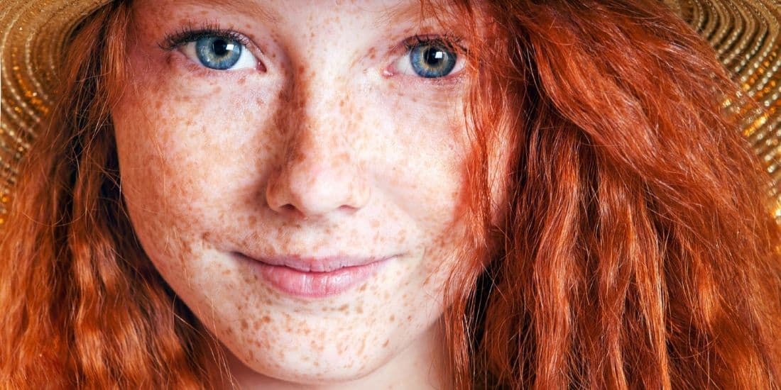 Heute können sich Besitzer von rotem Haar freuen – diese Haarfarbe gilt als die seltenste der Welt. img-15