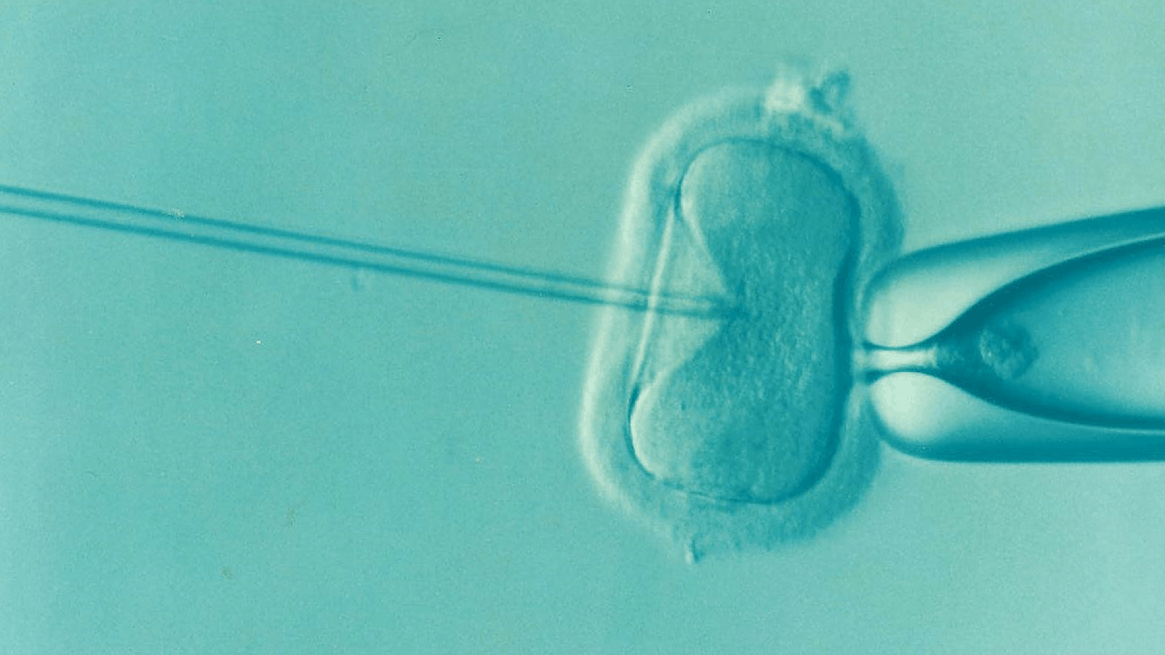 Eine neue Behandlung hilft bei unerfülltem Kinderwunsch ivf fruchtbarkeit unfruchtbarkeit icsi ovum samen